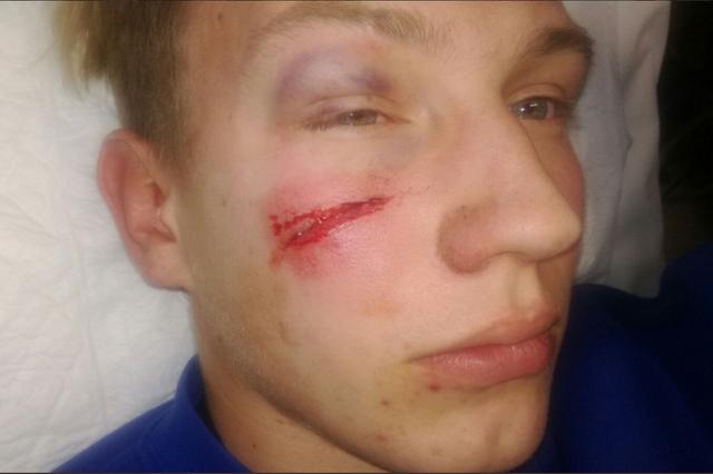 Iván Vallés, traslladat a l'hospital per un fort colp en la cara