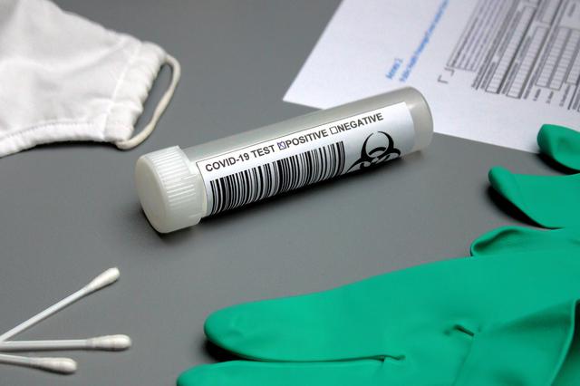La xifra oficial de casos de covid-19 actiu se situa en 54